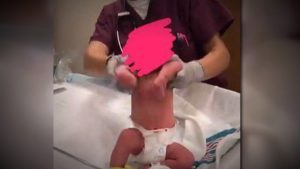 Nurse Pulls Baby'S Head off During Birth